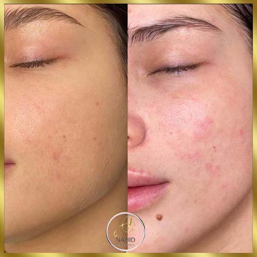 گالری پاکسازی پوست